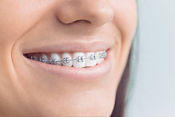 Why Choose Us for Your Dental Needs in Mineral Wells, TX
